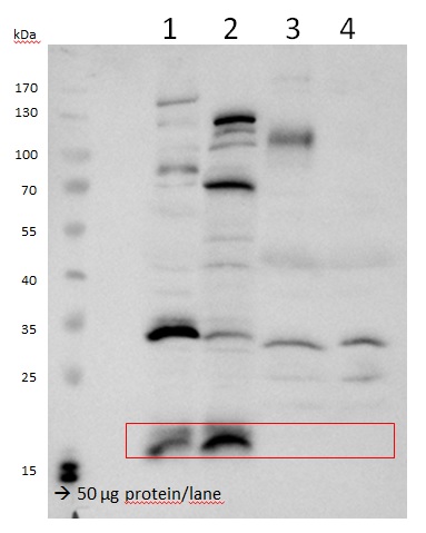 western blot using anti-VPS29 antibodies